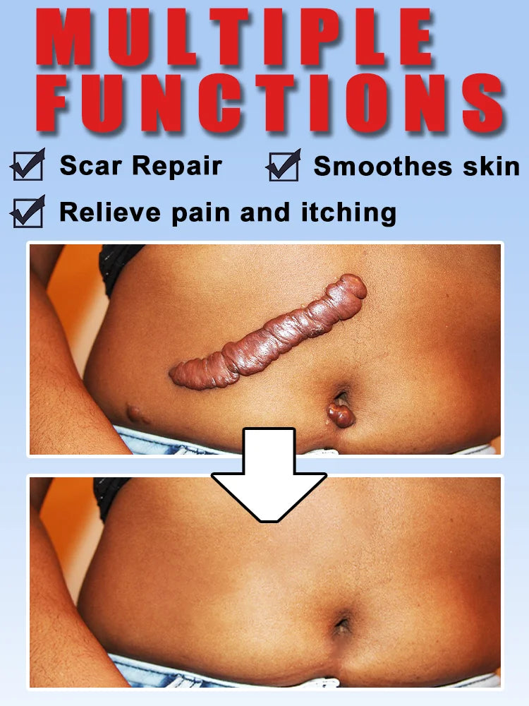 After Just One Use Scars Will Disappear And Your Skin Will Be Smooth Flawless And Look Like A New Face Cream