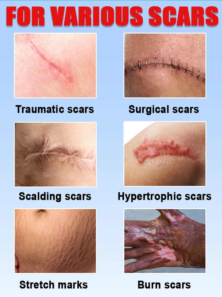 After Just One Use Scars Will Disappear And Your Skin Will Be Smooth Flawless And Look Like A New Face Cream