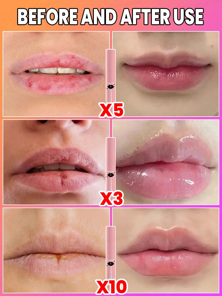 100 Percent Lip Augmentation Brush for Skin Rejuvenation in One Month